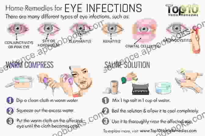 Antimicrobial Agents Effectively Combat Ocular Infections, Restoring Eye Health And Preserving Vision. Pharmacologic Therapy Of Ocular Disease (Handbook Of Experimental Pharmacology 242)