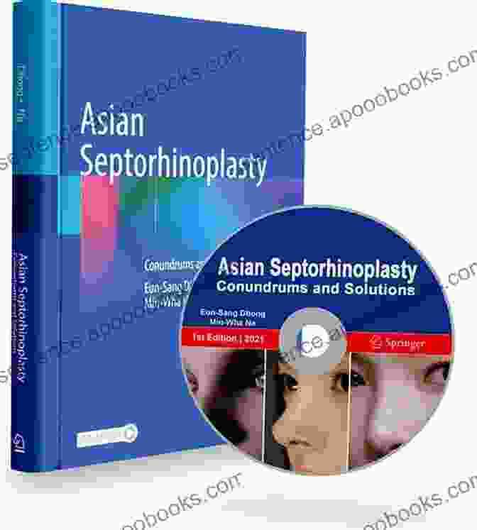 Asian Septorhinoplasty Conundrums And Solutions Asian Septorhinoplasty: Conundrums And Solutions