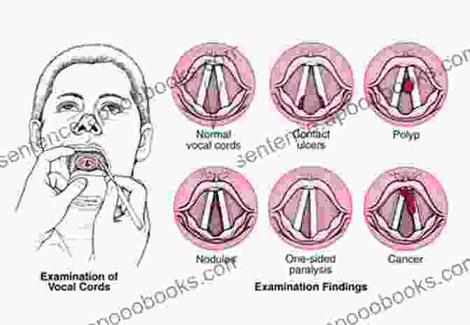 Chart Of Vocal Problems And Solutions Solutions For Singers: Tools For Performers And Teachers