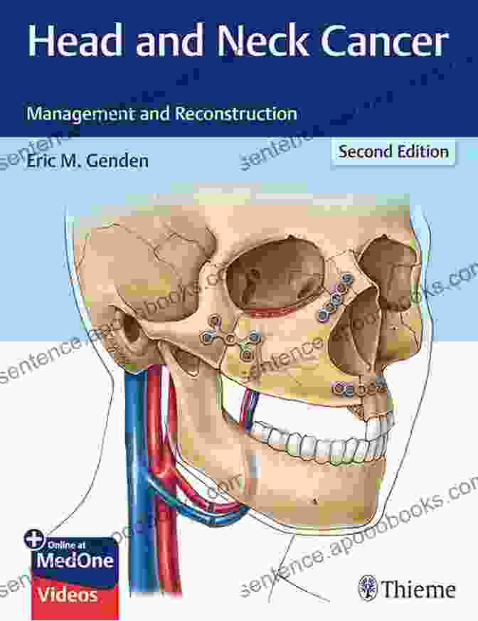 Head And Neck Cancer Reconstruction Scott Brown S Otorhinolaryngology And Head And Neck Surgery: Volume 3: Head And Neck Surgery Plastic Surgery