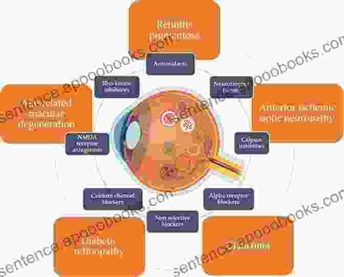 Neuroprotective Agents Shield The Eye From Neural Damage, Preserving Vision And Enhancing Quality Of Life. Pharmacologic Therapy Of Ocular Disease (Handbook Of Experimental Pharmacology 242)