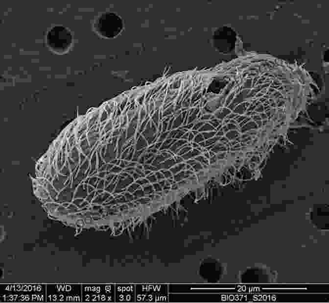 Scanning Electron Microscope Image Of A Tintinnid Ciliate, Showcasing Its Intricate Cilia The Biology And Ecology Of Tintinnid Ciliates: Models For Marine Plankton