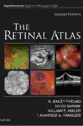 The Retinal Atlas Harrison Walker